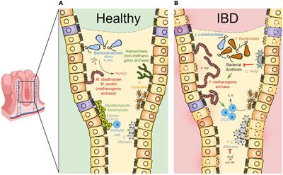 Going Beyond Bacteria: Uncovering the Role of Archaeome and Mycobiome in Inflammatory Bowel Disease